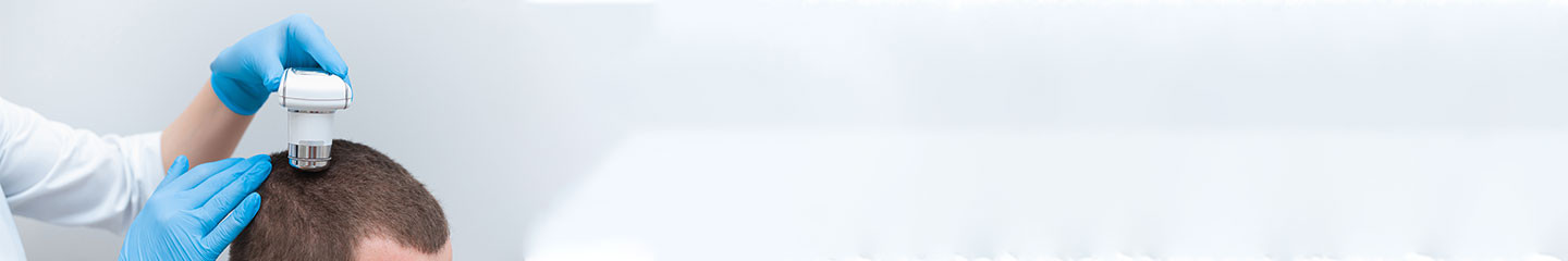 FUE Hajbeültetés 1 napos