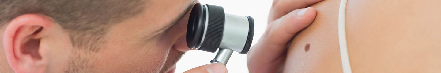 FUE Hajbeültetés Férfiaknak