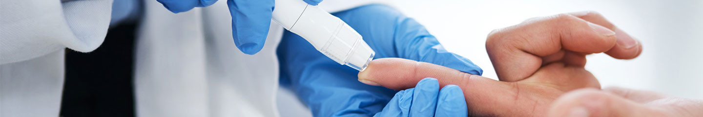 Norwood-Hamilton skála